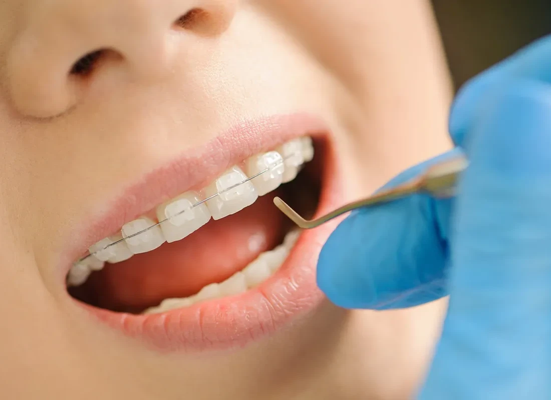 Preventive Dentistry at Bright Coast Dental in Carlsbad, CA
