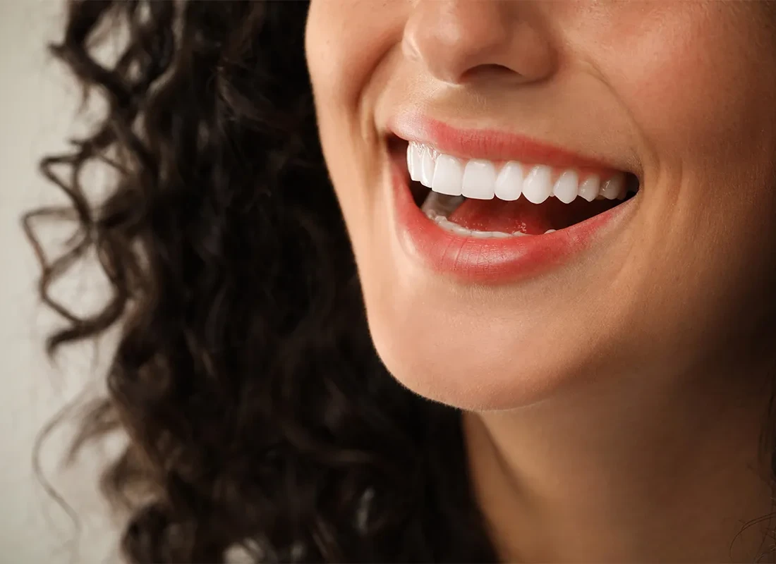 Gum Contouring at Bright Coast Dental