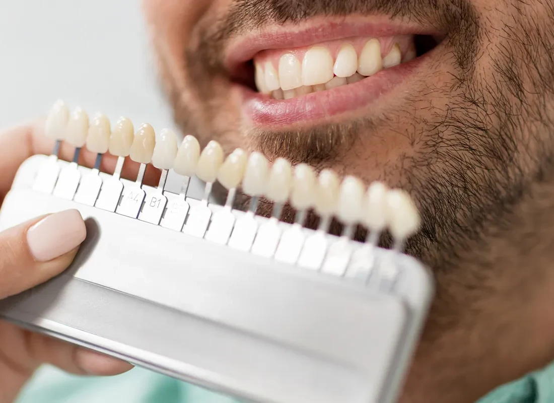 Teeth Whitening in Carlsbad, CA
