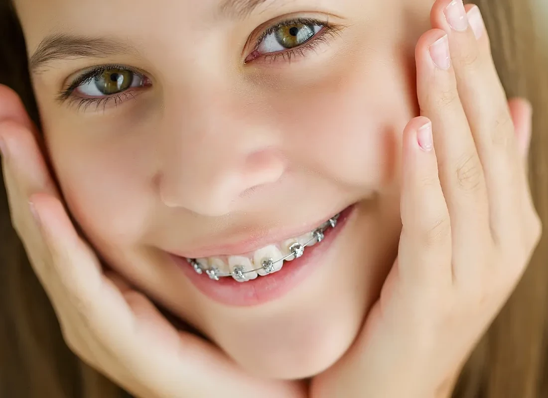 Fastbraces in Carlsbad, CA