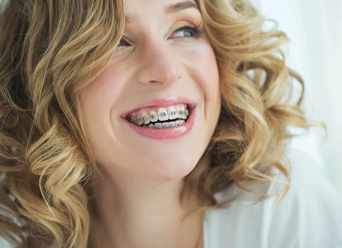 Fastbraces at Bright Coast Dental