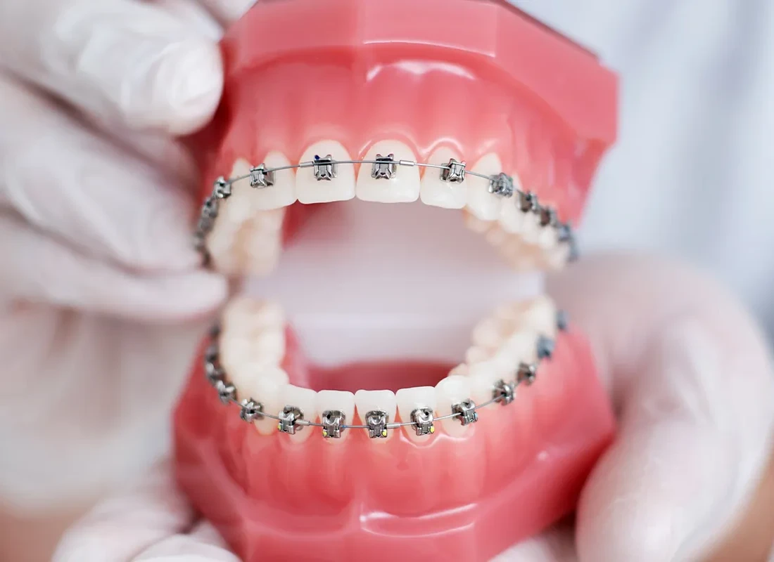 Orthodontics at Bright Coast Dental