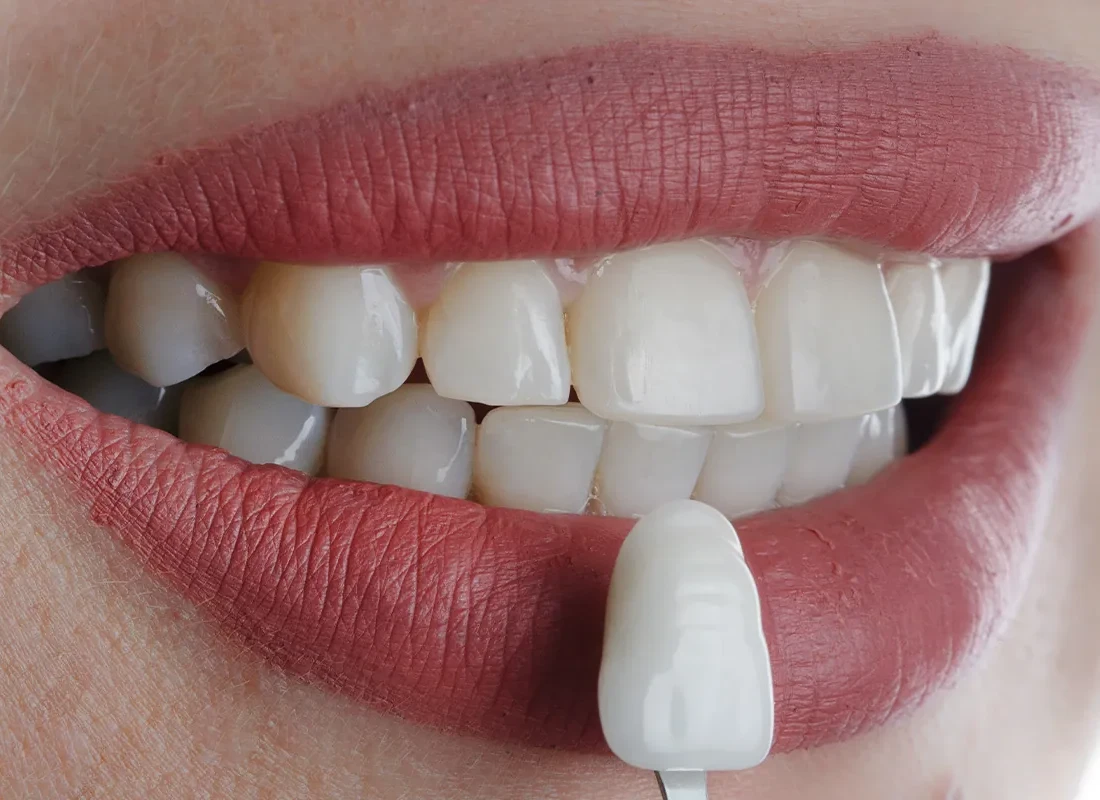 Botox in Carlsbad, CA