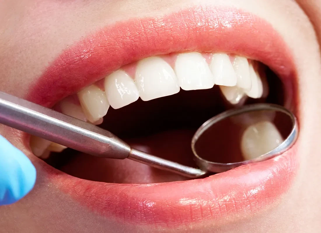 Dental Exams & X-Rays at Bright Coast Dental