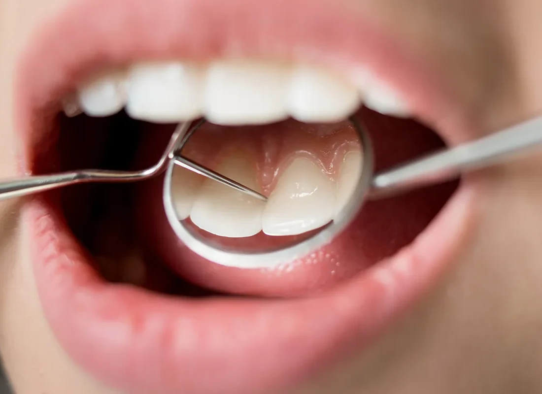 Teeth Cleaning (Prophy) in Carlsbad, CA