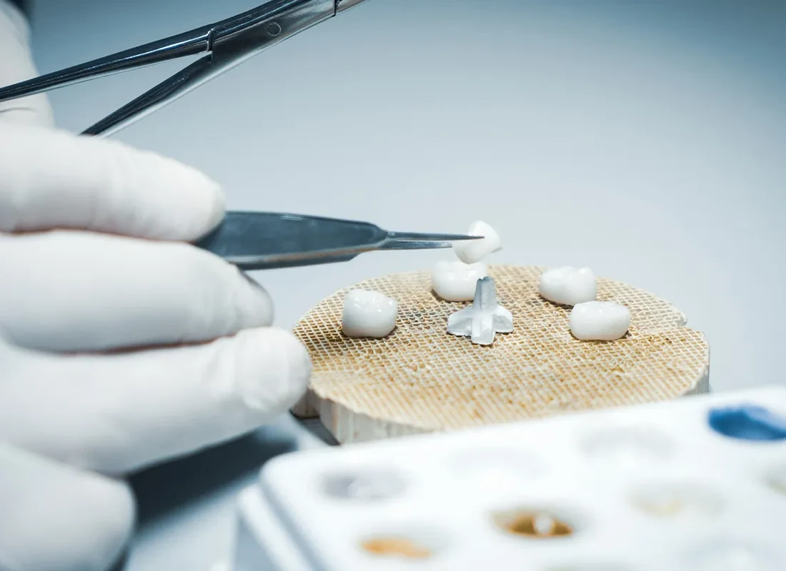 Dental Crowns at Bright Coast Dental