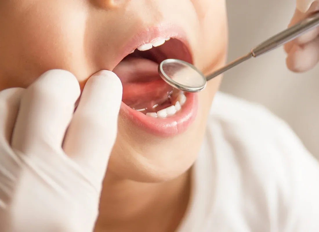 Pediatric Care at Bright Coast Dental