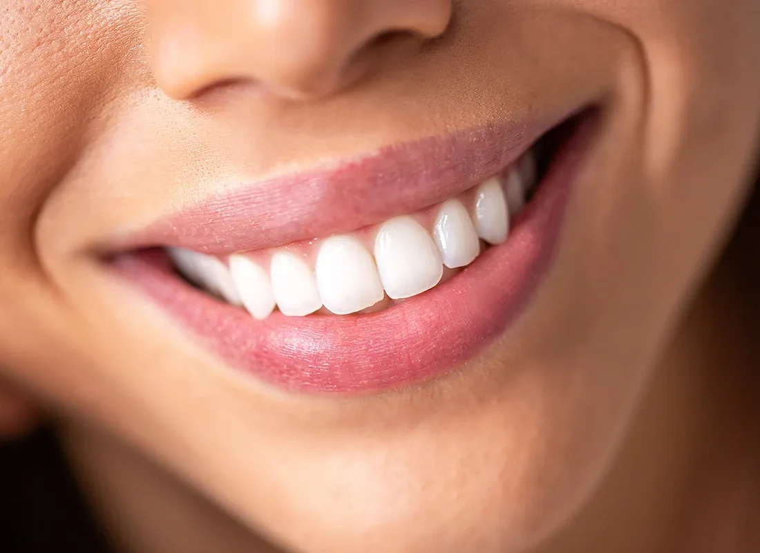 Full Mouth Reconstruction at Bright Coast Dental