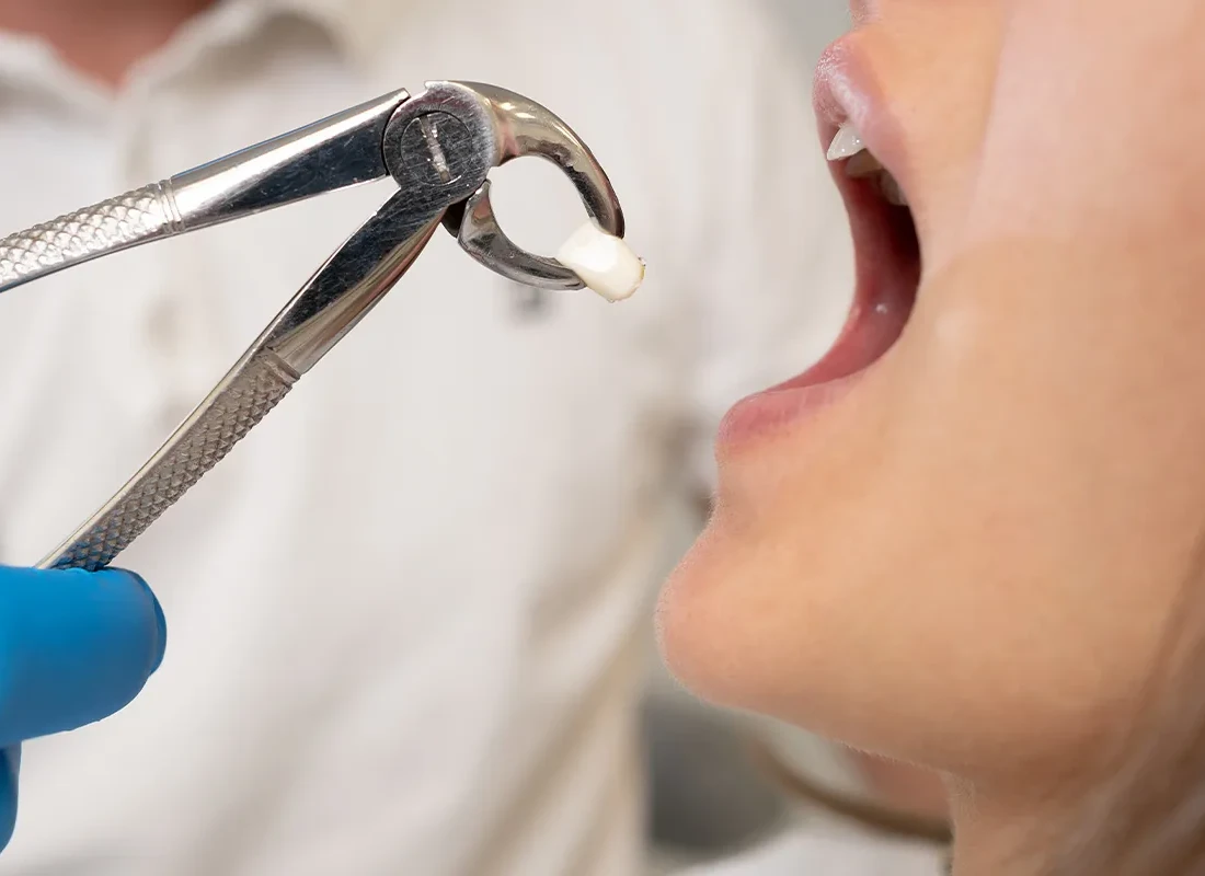 Oral Surgery at Bright Coast Dental in Carlsbad, CA